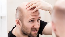 Tóc rụng nhanh, mọc chậm vì mất cân bằng dinh dưỡng