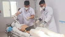 Nam sinh lớp 11 bỏng nặng do đốt pháo hoa ngày ông Công ông Táo 2022. Ảnh: Sức khỏe & Đời sống.