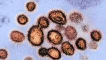 Phát hiện mẫu virus SARS-CoV-2 đầu tiên bị xóa khỏi cơ sở dữ liệu của Viện Y tế Quốc gia Mỹ