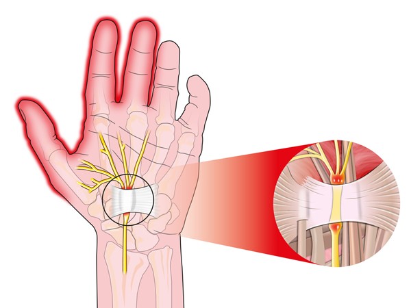 Ảnh hưởng đến hệ thần kinh Ảnh hưởng đến hệ thần kinh