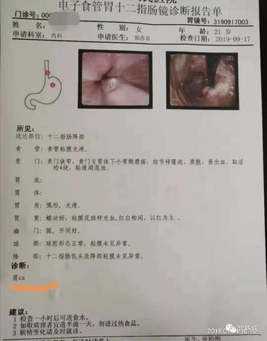 Cô gái 21 tuổi đã bị ung thư, bác sĩ cảnh báo thói quen xấu ở giới trẻ