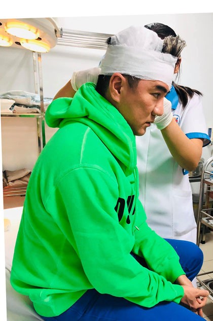 Đàm Vĩnh Hưng bị tai nạn trên sân khấu - 1