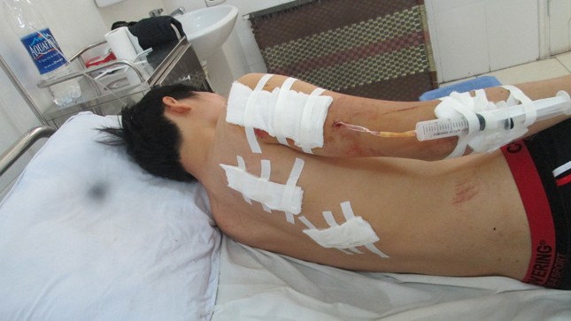 Anh Nam bị bố gây thương tích