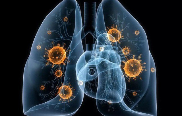 Cô gái 25 tuổi bị ung thư, nguyên nhân do chính thứ luôn có trong bếp của mọi nhà gây ra ảnh 4