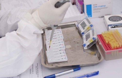 Thêm 1 bệnh nhân ở Hà Nội tái dương tính với SARS-CoV-2. sau 2 tuần ra viện