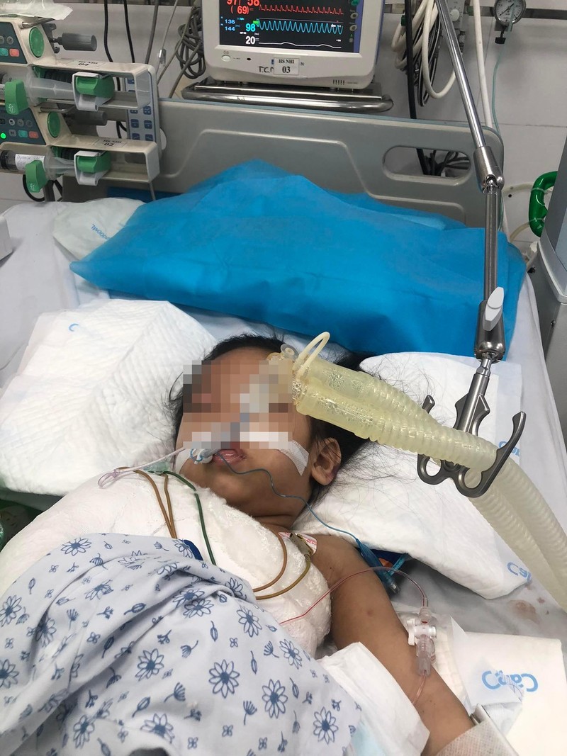 Xót xa nhìn hình ảnh mới nhất tại bệnh viện của bé gái 3 tuổi bị đóng 9 chiếc đinh vào đầu