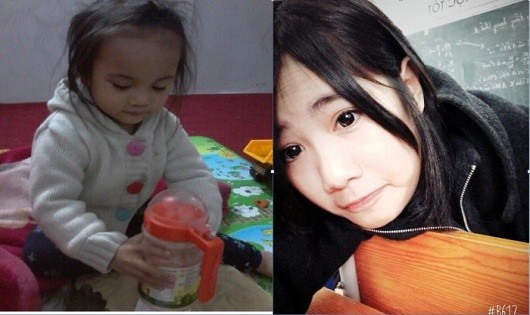 Không may cho chị Hương cả hai cô con gái đều bị ngộ độc
