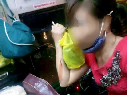 Truy tìm nhóm lạ mặt ném vỡ kính xe khách ở Thanh Hóa làm 1 phụ nữ bị thương - Ảnh 2. Truy tìm nhóm lạ mặt ném vỡ kính xe khách ở Thanh Hóa làm 1 phụ nữ bị thương - Ảnh 2.