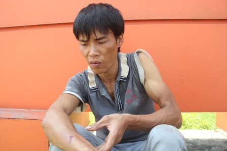 Tài xế Phạm Văn Tuân bị hành hung,